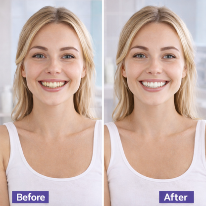 Purple Teeth Whitening Strips with Free Cheek Retractor
